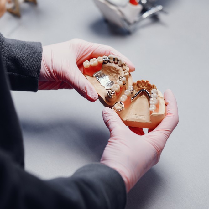 Denture Relines