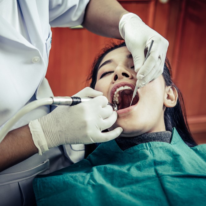 Tooth Extraction
