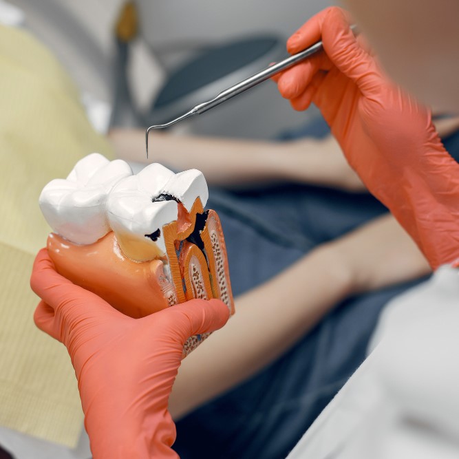 Root Canal Therapy