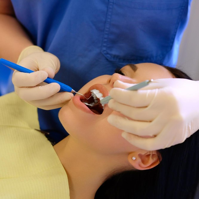 Composite Filling